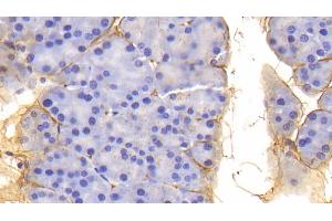 Detection of PIIINP in Mouse Pancreas Tissue using Polyclonal Antibody to Procollagen III N-Terminal Propeptide (PIIINP) (PIIINP 抗体  (AA 24-154))