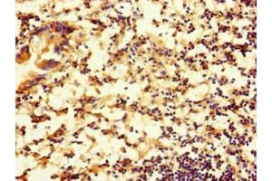 Immunohistochemistry of paraffin-embedded human appendix tissue using ABIN7167753 at dilution of 1:100 (RTN4IP1 抗体  (AA 41-396))