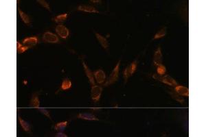 Immunofluorescence analysis of NIH-3T3 cells using USP30 Polyclonal Antibody at dilution of 1:100 (40x lens).