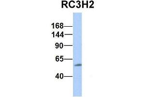 Host:  Rabbit  Target Name:  CHAD  Sample Type:  Human Adult Placenta  Antibody Dilution:  1. (RC3H2 抗体  (Middle Region))