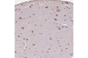Immunohistochemical staining (Formalin-fixed paraffin-embedded sections) of human cerebral cortex shows moderate cytoplasmic and nucleolar positivity in neuronal cells with PNMA2 polyclonal antibody . (PNMA2 抗体  (AA 58-206))