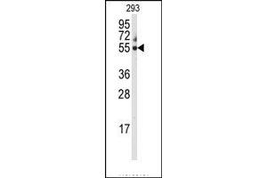 Image no. 1 for anti-Cytochrome P450, Family 3, Subfamily A, Polypeptide 5 (CYP3A5) (C-Term) antibody (ABIN360105)