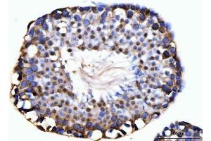 IHC analysis of KIFC1 using anti-KIFC1 antibody (ABIN7599523).