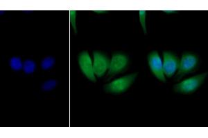Immunofluorescence (IF) image for anti-Glutathione S-Transferase pi 1 (GSTP1) (AA 1-210) antibody (ABIN7433147)