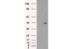 Western Blotting (WB) image for anti-Sorbitol Dehydrogenase (SORD) antibody (ABIN1501077) (SORD 抗体)
