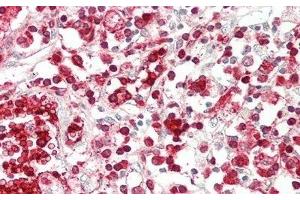 Detection of ABCG1 in Human Thymus Tissue using Polyclonal Antibody to ATP Binding Cassette Transporter G1 (ABCG1)