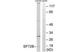 Western blot analysis of extracts from LOVO cells, using SFT2B Antibody. (Vesicle Transport Protein SFT2B (SFT2B) (AA 61-110) 抗体)