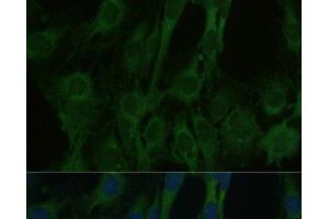 Immunofluorescence analysis of C6 cells using FABP7 Polyclonal Antibody at dilution of 1:100. (FABP7 抗体)