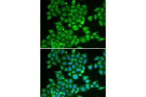 Immunofluorescence analysis of U2OS cells using PDE1B antibody. (PDE1B 抗体  (AA 190-536))