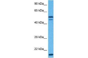 Host:  Rabbit  Target Name:  EIF3E  Sample Tissue:  Human Hela Whole Cell  Antibody Dilution:  1ug/ml (EIF3E 抗体  (Middle Region))
