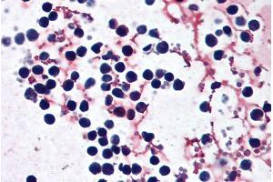 ABIN570839 (5µg/ml) staining of paraffin embedded Human peripheral blood leukocytes.