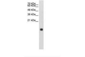 Image no. 1 for anti-Cystatin S (CST4) (N-Term) antibody (ABIN203409) (CST4 抗体  (N-Term))