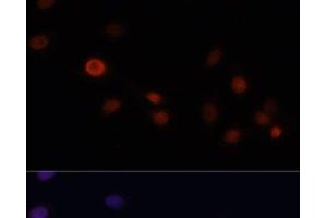 Immunofluorescence analysis of C6 cells using p21 Polyclonal Antibody at dilution of 1:100. (p21 抗体)