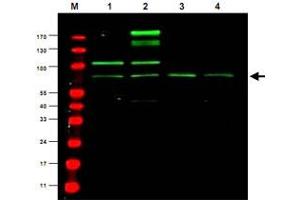 Western blot using Rreb1 polyclonal antibody  shows detection ofa predominant band believed to be Rreb1 invarious cell lysates (1 - HEK293, 2 - RFP-Rreb transfected HEK293, 3 - M460 and 4 - T1165). (RREB1 抗体)