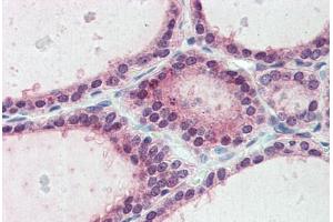 Immunohistochemistry (IHC) image for anti-Extended Synaptotagmin-Like Protein 1 (ESYT1) (Internal Region) antibody (ABIN1048589)
