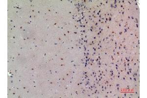 Immunohistochemistry (IHC) analysis of paraffin-embedded Mouse Brain, antibody was diluted at 1:100. (NCOA3 抗体  (Internal Region))