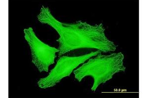 Immunofluorescence of monoclonal antibody to TUBA4A on HeLa cell. (TUBA4A 抗体  (AA 1-448))