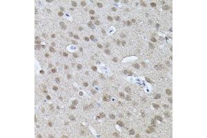 Immunohistochemistry of paraffin-embedded mouse brain using RNF166 antibody (ABIN6135036, ABIN6147021, ABIN6147024 and ABIN6224290) (40x lens). (RNF166 抗体  (C-Term))