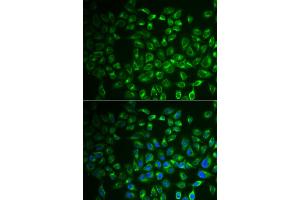 Immunofluorescence analysis of A549 cells using FABP6 antibody. (FABP6 抗体)