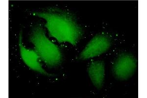 Immunofluorescence of monoclonal antibody to TXNDC9 on HeLa cell. (TXNDC9 抗体  (AA 1-226))