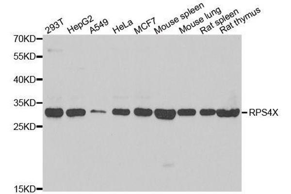 RPS4X 抗体  (AA 66-263)