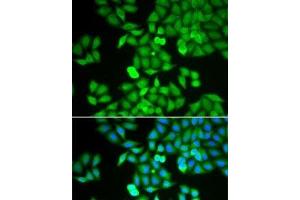 Immunofluorescence analysis of HeLa cells using ARHGDIA Polyclonal Antibody (ARHGDIA 抗体)