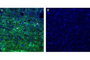 Free-floating frozen brain sections from a paraformaldehyde-perfused rat were incubated with Anti-CCC9 (SLC12A8) (extracellular) Antibody (ABIN7885433, 1:300), followed by goat anti-rabbit secondary antibody conjugated to Alexa Fluor® 488 (green).