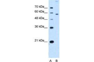 Western Blotting (WB) image for anti-Solute Carrier Family 22 (Organic Cation Transporter), Member 2 (SLC22A2) antibody (ABIN2462742)