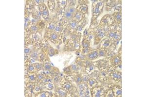 Immunohistochemistry of paraffin-embedded mouse liver using CYP2C18 antibody. (CYP2C18 抗体)
