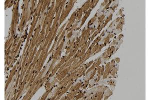 ABIN6273325 at 1/100 staining Mouse heart tissue by IHC-P. (SUGT1 抗体  (C-Term))