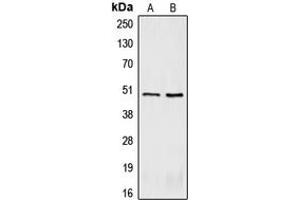 Western Blotting (WB) image for anti-Corticotropin Releasing Hormone Receptor 2 (CRHR2) (Center) antibody (ABIN7295364)