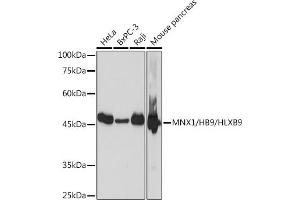 Western blot analysis of extracts of various cell lines, using MNX1/MNX1/HB9/HLXB9 Rabbit mAb (ABIN7268684) at 1:1000 dilution. (MNX1 抗体)