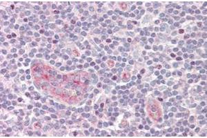 Human Tonsil: Formalin-Fixed, Paraffin-Embedded (FFPE)
