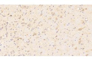 Immunohistochemistry (IHC) image for anti-NADPH Oxidase 3 (NOX3) (AA 221-466) antibody (ABIN7443122)