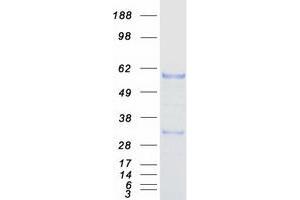 Western Blotting (WB) image for Estrogen-Related Receptor gamma (ESRRG) (Transcript Variant 1) protein (Myc-DYKDDDDK Tag) (ABIN2720565)