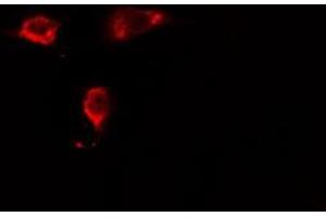 ABIN6275432 staining HeLa cells by IF/ICC. (RABEP2 抗体  (Internal Region))