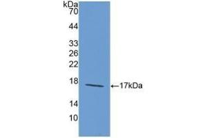 Detection of Recombinant LAMa1, Rat using Polyclonal Antibody to Laminin Alpha 1 (LAMA1) (Laminin alpha 1 抗体  (AA 1156-1276))