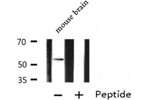 Western blot analysis of extracts from Mouse brain lysate, using ARX antibody. (Arx 抗体  (Internal Region))