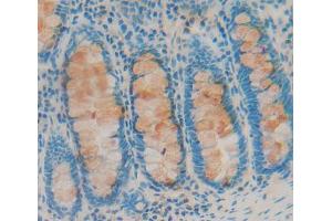 Used in DAB staining on fromalin fixed paraffin- embedded rectum tissue (ABCE1 抗体  (AA 389-556))