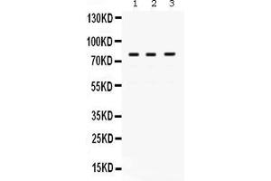 Anti- POLH Picoband antibody, Western blottingAll lanes: Anti POLH  at 0. (POLH 抗体  (AA 157-361))