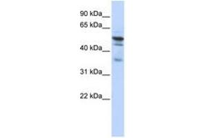 Image no. 1 for anti-N-Myristoyltransferase 1 (NMT1) (AA 108-157) antibody (ABIN6740963) (NMT1 抗体  (AA 108-157))