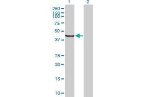 Western Blot analysis of SCLY expression in transfected 293T cell line by SCLY MaxPab polyclonal antibody. (SCLY 抗体  (AA 1-445))