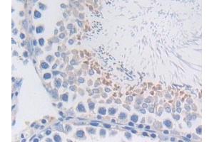 Detection of MFGE8 in Rat Testis Tissue using Polyclonal Antibody to Milk Fat Globule EGF Factor 8 (MFGE8) (MFGE8 抗体  (AA 73-421))
