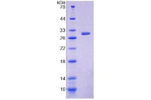 SDS-PAGE analysis of Human ALOX12B Protein. (ALOX12B 蛋白)