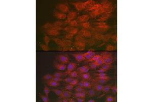 Immunofluorescence analysis of C6 cells using LML Rabbit pAb (ABIN7268204) at dilution of 1:250 (40x lens). (LMAN2L 抗体)