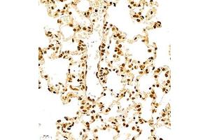 Immunohistochemistry of paraffin embedded rat lung using RB1 (ABIN7075477) at dilution of 1:700 (400x lens) (RBM45 抗体)
