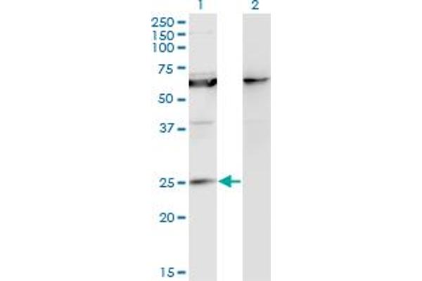 KCNIP1 antibody  (AA 1-216)