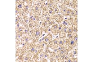 Immunohistochemistry of paraffin-embedded human liver injury using ST3GAL3 antibody (ABIN5974085) at dilution of 1/100 (40x lens). (ST3GAL3 抗体)