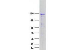 Western Blotting (WB) image for ATPase, Ca++ Transporting, Cardiac Muscle, Fast Twitch 1 (ATP2A1) (Transcript Variant A) protein (Myc-DYKDDDDK Tag) (ABIN2715042)
