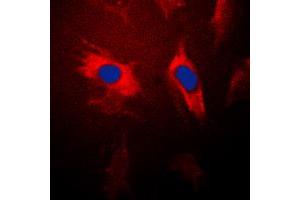 Immunofluorescent analysis of 14-3-3 theta staining in HeLa cells. (14-3-3 theta 抗体  (Center))